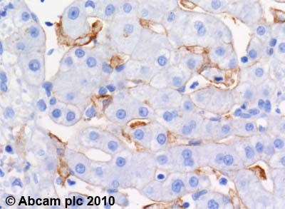 Immunohistochemistry (Formalin/PFA-fixed paraffin-embedded sections) - Anti-ABCA1 antibody [HJ1] - BSA and Azide free (AB264550), expandable thumbnail
