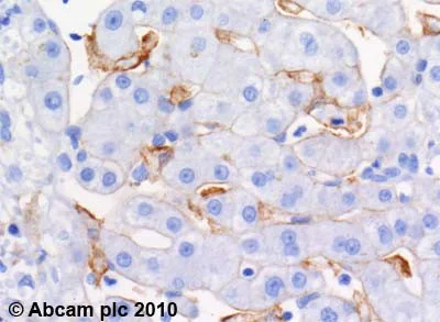 Immunohistochemistry (Formalin/PFA-fixed paraffin-embedded sections) - Anti-ABCA1 antibody [HJ1] - BSA and Azide free (AB264550)
