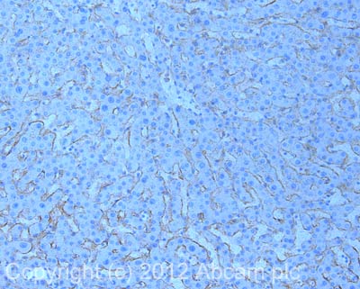 Immunohistochemistry (Formalin/PFA-fixed paraffin-embedded sections) - Anti-ABCA1 antibody [HJ1] - BSA and Azide free (AB264550), expandable thumbnail