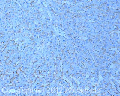 Immunohistochemistry (Formalin/PFA-fixed paraffin-embedded sections) - Anti-ABCA1 antibody [HJ1] - BSA and Azide free (AB264550)