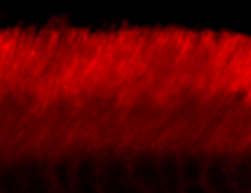 Immunohistochemistry (Formalin/PFA-fixed paraffin-embedded sections) - Anti-ABCA4 antibody [3F4] (AB77285)