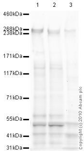 Western blot - Anti-ABCA4 antibody [3F4] (AB77285)