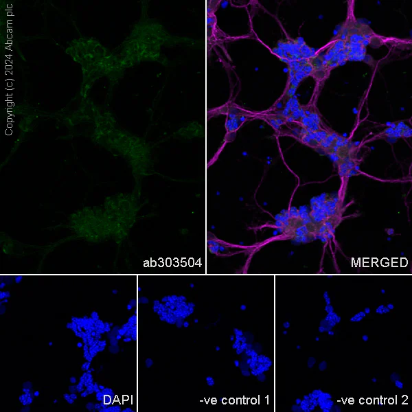 Immunocytochemistry/ Immunofluorescence - Anti-ABCA4 antibody [EPR26543-66] (AB303504)