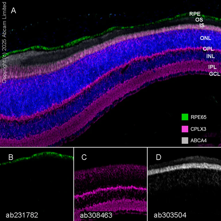 Multiplex immunohistochemistry - Anti-ABCA4 antibody [EPR26543-66] (AB303504)