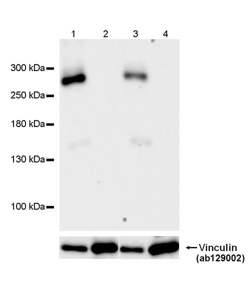 Western blot - Anti-ABCA4 antibody [EPR26543-66] (AB303504)