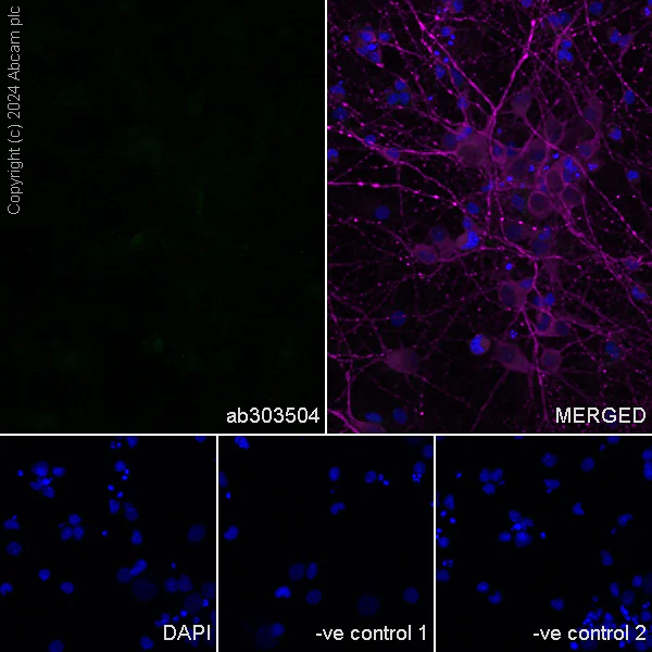 Immunocytochemistry/ Immunofluorescence - Anti-ABCA4 antibody [EPR26543-66] - BSA and Azide free (AB303505)