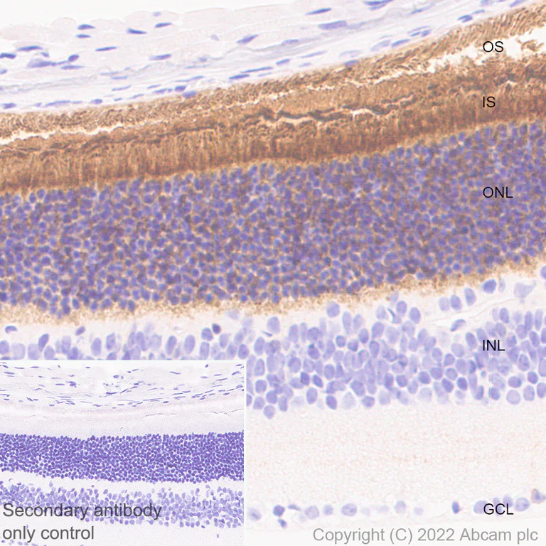 Immunohistochemistry (Formalin/PFA-fixed paraffin-embedded sections) - Anti-ABCA4 antibody [EPR26543-66] - BSA and Azide free (AB303505)