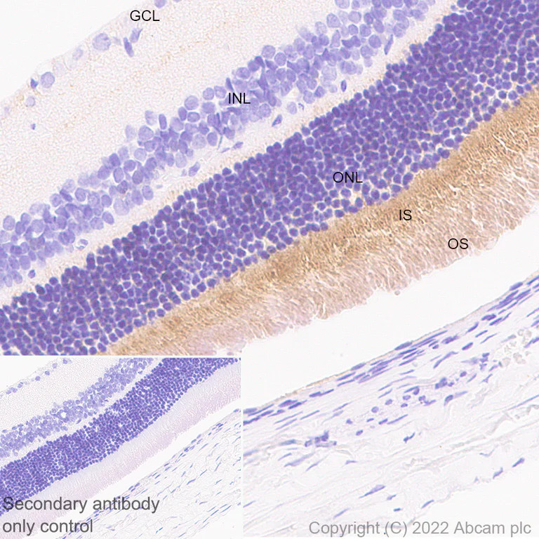 Immunohistochemistry (Formalin/PFA-fixed paraffin-embedded sections) - Anti-ABCA4 antibody [EPR26543-66] - BSA and Azide free (AB303505)