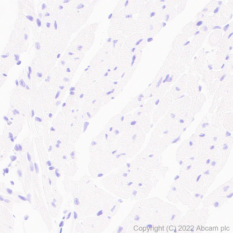 Immunohistochemistry (Formalin/PFA-fixed paraffin-embedded sections) - Anti-ABCA4 antibody [EPR26543-66] - BSA and Azide free (AB303505)