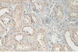 Immunohistochemistry (Formalin/PFA-fixed paraffin-embedded sections) - Anti-ABCA5 antibody (AB99953)