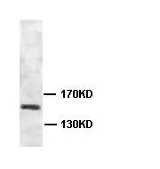 Western blot - Anti-ABCA5 antibody (AB99953)