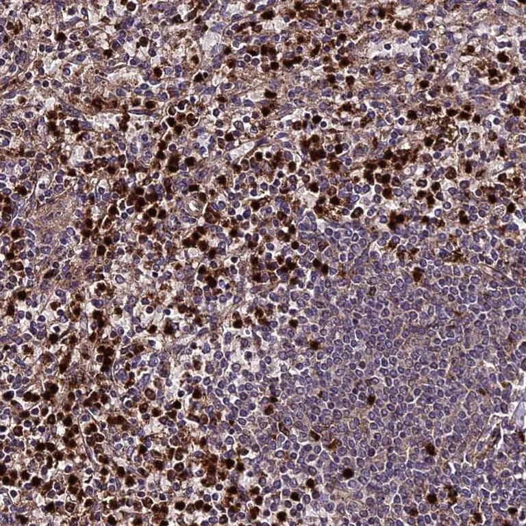 Immunohistochemistry (Formalin/PFA-fixed paraffin-embedded sections) - Anti-ABCA7 antibody (AB247027)