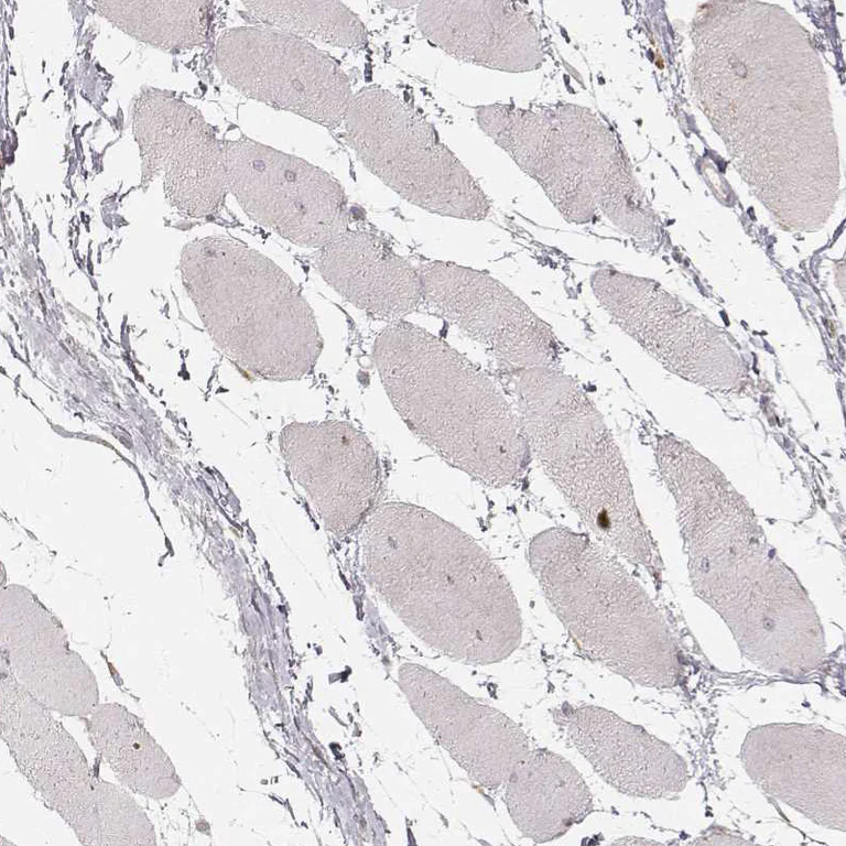 Immunohistochemistry (Formalin/PFA-fixed paraffin-embedded sections) - Anti-ABCA7 antibody (AB247027)