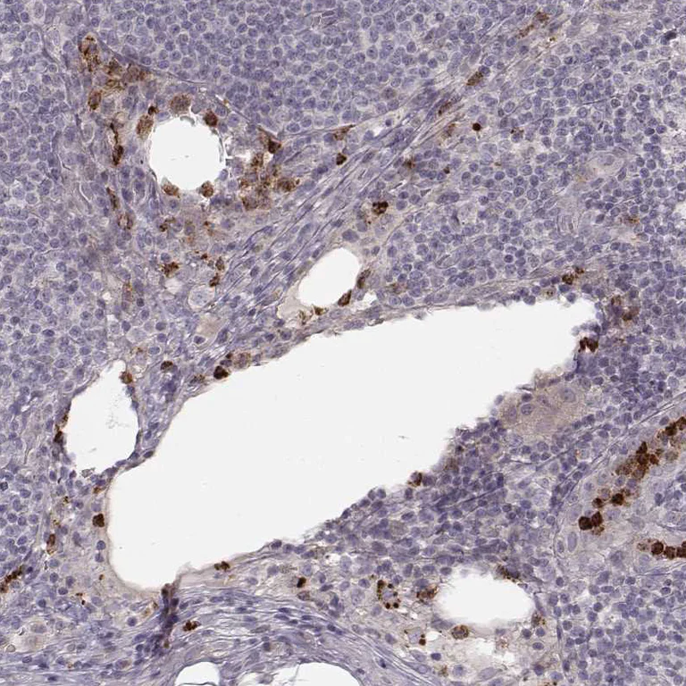 Immunohistochemistry (Formalin/PFA-fixed paraffin-embedded sections) - Anti-ABCA7 antibody (AB247027)