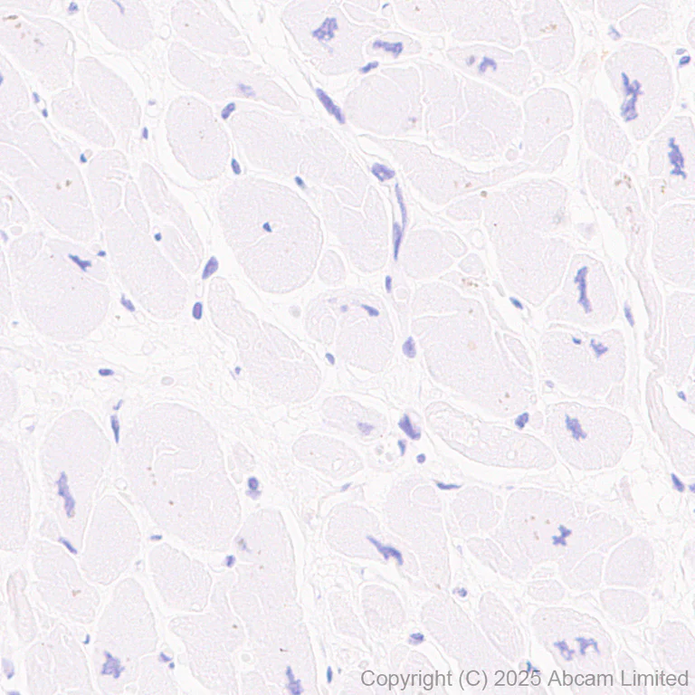 Immunohistochemistry (Formalin/PFA-fixed paraffin-embedded sections) - Anti-ABCA7 antibody [EPR28772-170] (AB323799)