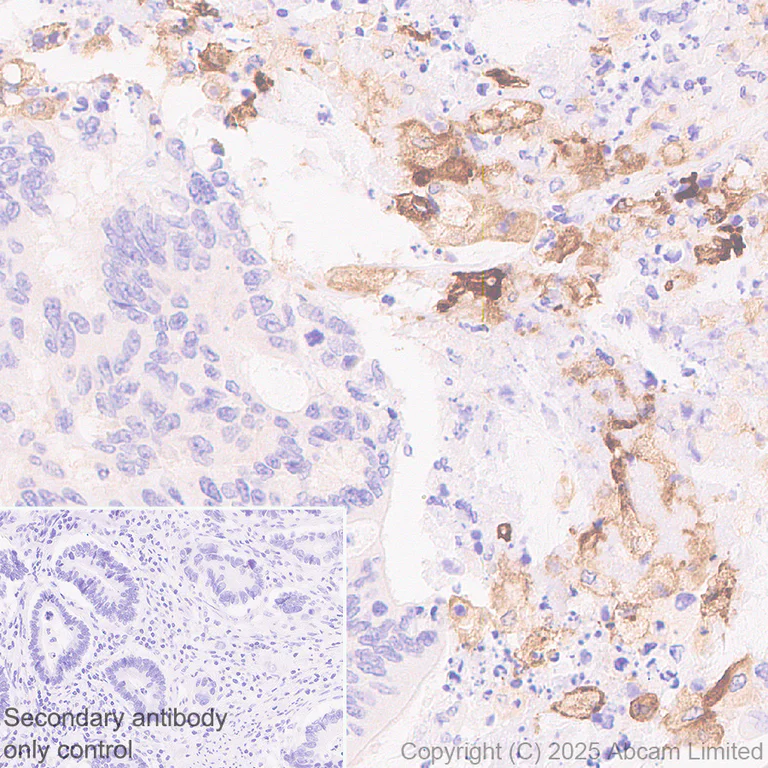 Immunohistochemistry (Formalin/PFA-fixed paraffin-embedded sections) - Anti-ABCA7 antibody [EPR28772-170] (AB323799)