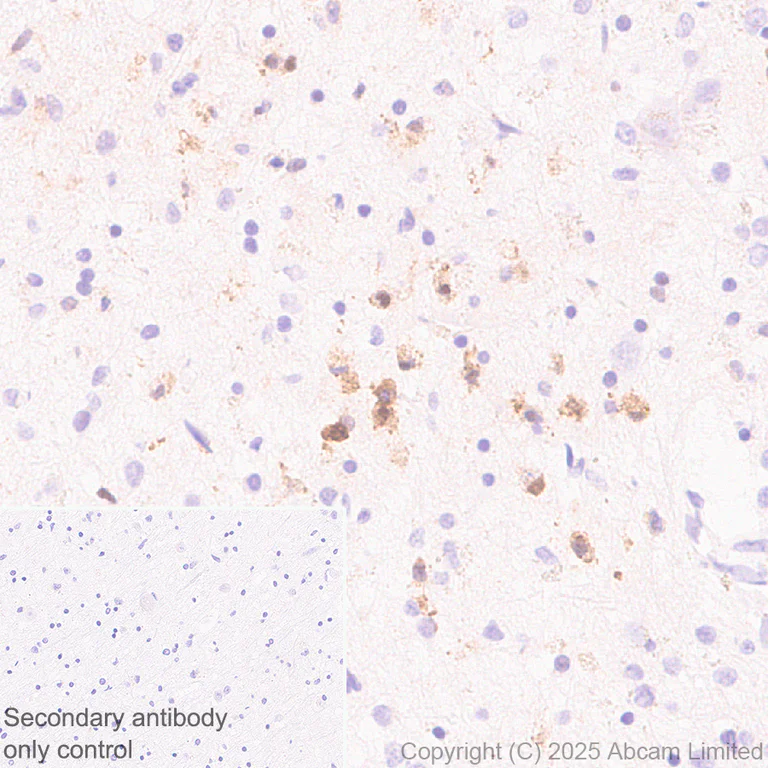 Immunohistochemistry (Formalin/PFA-fixed paraffin-embedded sections) - Anti-ABCA7 antibody [EPR28772-170] (AB323799)