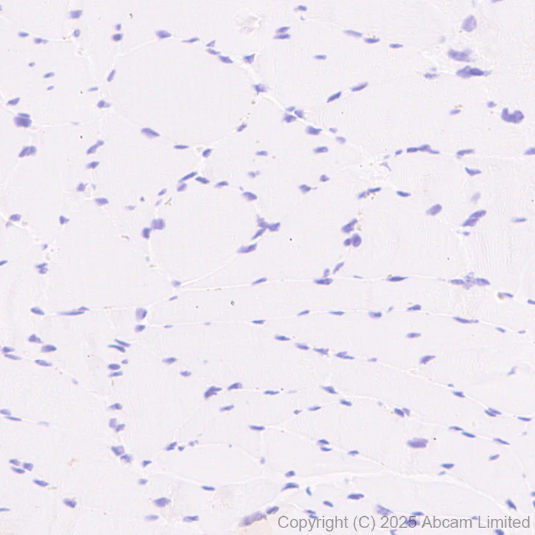 Immunohistochemistry (Formalin/PFA-fixed paraffin-embedded sections) - Anti-ABCA7 antibody [EPR28772-170] (AB323799)
