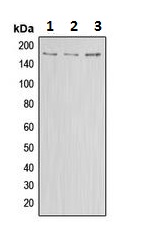 Western blot - Anti-ABCA8 antibody (AB230896)