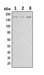 Western blot - Anti-ABCA8 antibody (AB230896)