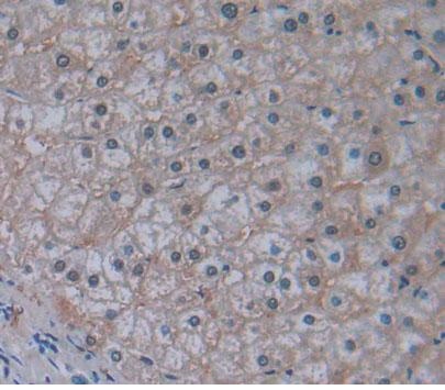 Immunohistochemistry (Formalin/PFA-fixed paraffin-embedded sections) - Anti-ABCB10 antibody (AB231535)
