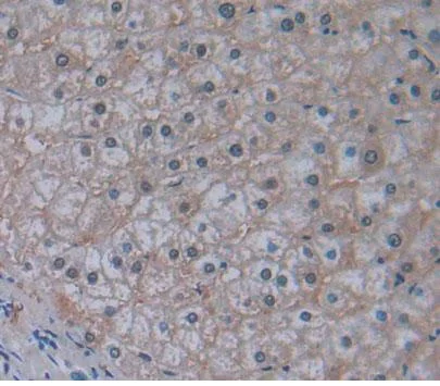 Immunohistochemistry (Formalin/PFA-fixed paraffin-embedded sections) - Anti-ABCB10 antibody (AB231535)