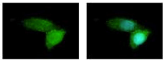 Immunocytochemistry/ Immunofluorescence - Anti-ABCB11/BSEP antibody (AB155421)