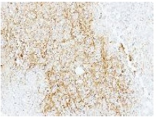 Immunohistochemistry (Formalin/PFA-fixed paraffin-embedded sections) - Anti-ABCB11/BSEP antibody (AB155421)