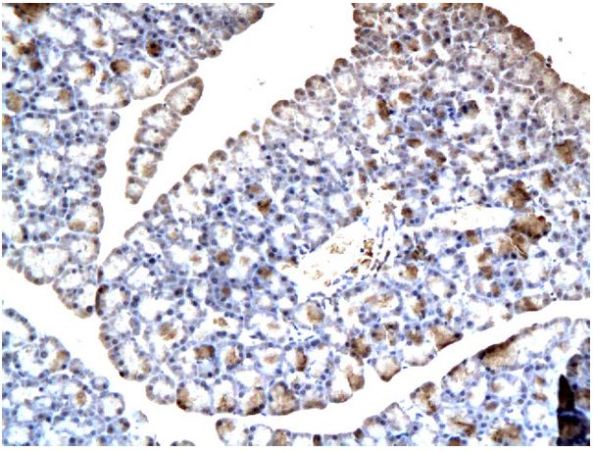 Immunohistochemistry (Formalin/PFA-fixed paraffin-embedded sections) - Anti-ABCB11/BSEP antibody (AB217532), expandable thumbnail