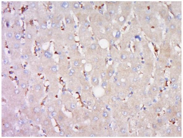 Immunohistochemistry (Formalin/PFA-fixed paraffin-embedded sections) - Anti-ABCB11/BSEP antibody (AB217532), expandable thumbnail