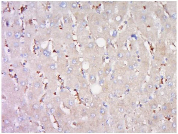 Immunohistochemistry (Formalin/PFA-fixed paraffin-embedded sections) - Anti-ABCB11/BSEP antibody (AB217532)