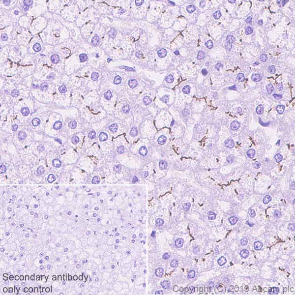 Immunohistochemistry (Formalin/PFA-fixed paraffin-embedded sections) - Anti-ABCB11/BSEP antibody [EPR22670-64] (AB255605), expandable thumbnail