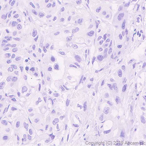Immunohistochemistry (Formalin/PFA-fixed paraffin-embedded sections) - Anti-ABCB11/BSEP antibody [EPR22670-64] (AB255605)