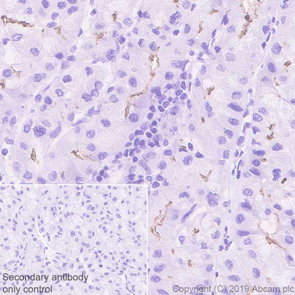Immunohistochemistry (Formalin/PFA-fixed paraffin-embedded sections) - Anti-ABCB11/BSEP antibody [EPR22670-64] (AB255605), expandable thumbnail
