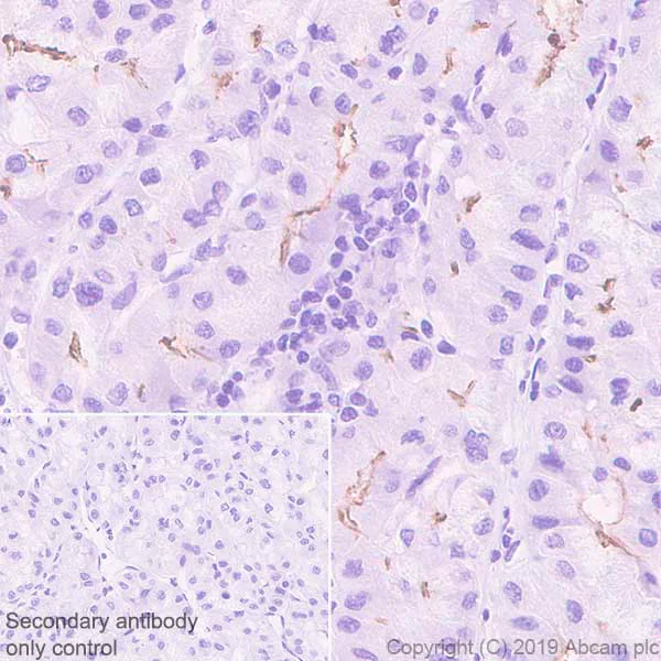 Immunohistochemistry (Formalin/PFA-fixed paraffin-embedded sections) - Anti-ABCB11/BSEP antibody [EPR22670-64] (AB255605)