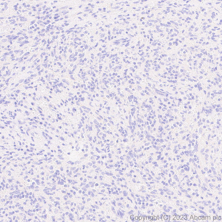 Immunohistochemistry (Formalin/PFA-fixed paraffin-embedded sections) - Anti-ABCB11/BSEP antibody [EPR28773-83] (AB315474)