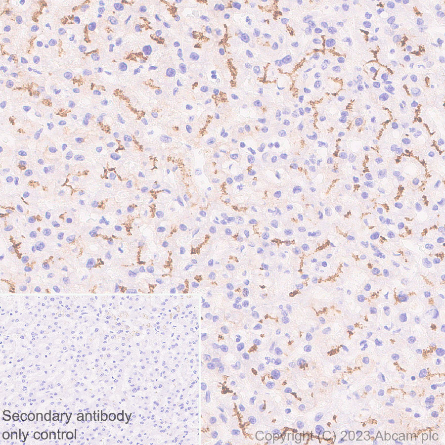 Immunohistochemistry (Formalin/PFA-fixed paraffin-embedded sections) - Anti-ABCB11/BSEP antibody [EPR28773-83] - BSA and Azide free (ab315475), expandable thumbnail