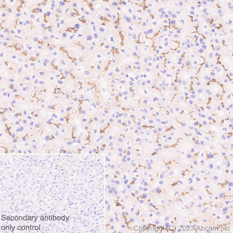 Immunohistochemistry (Formalin/PFA-fixed paraffin-embedded sections) - Anti-ABCB11/BSEP antibody [EPR28773-83] - BSA and Azide free (AB315475)