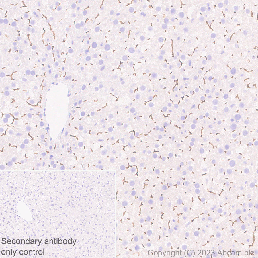 Immunohistochemistry (Formalin/PFA-fixed paraffin-embedded sections) - Anti-ABCB11/BSEP antibody [EPR28773-83] - BSA and Azide free (ab315475), expandable thumbnail