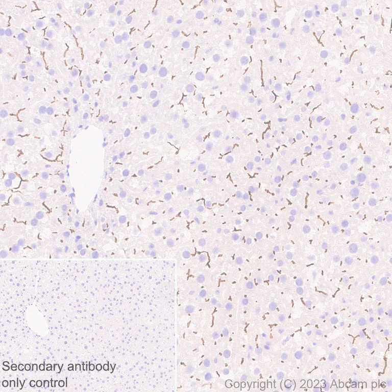 Immunohistochemistry (Formalin/PFA-fixed paraffin-embedded sections) - Anti-ABCB11/BSEP antibody [EPR28773-83] - BSA and Azide free (AB315475)