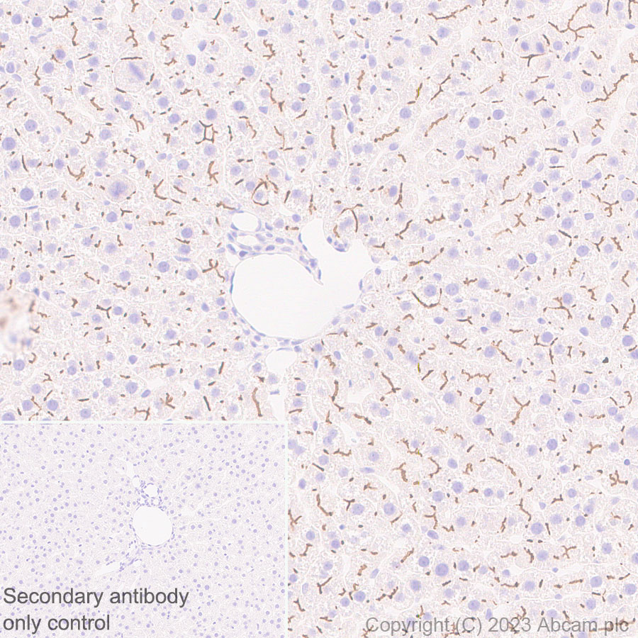 Immunohistochemistry (Formalin/PFA-fixed paraffin-embedded sections) - Anti-ABCB11/BSEP antibody [EPR28773-83] - BSA and Azide free (ab315475), expandable thumbnail