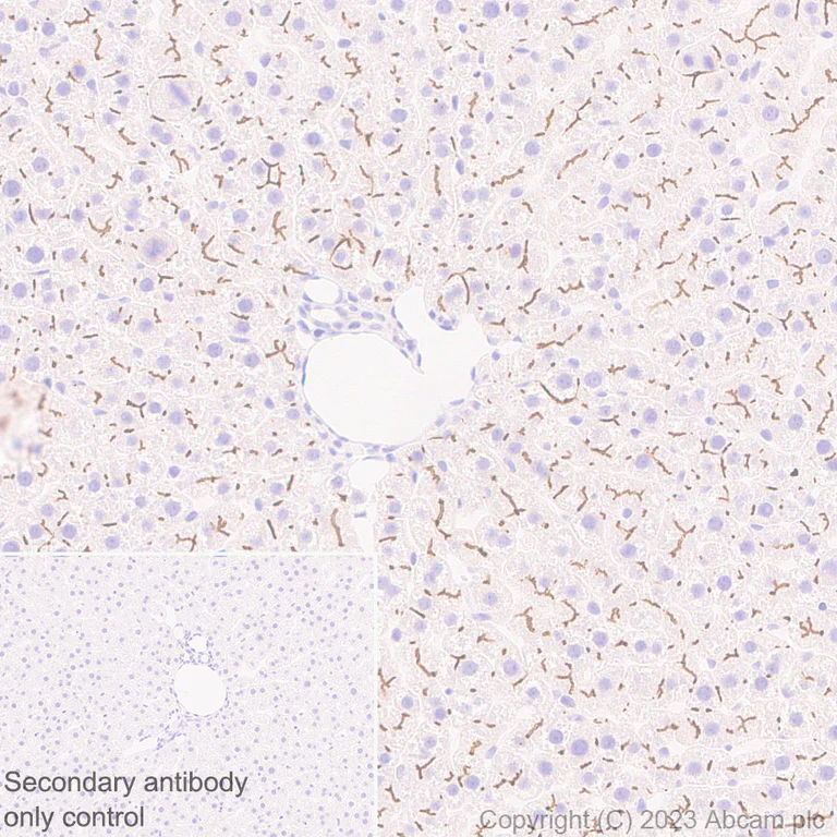 Immunohistochemistry (Formalin/PFA-fixed paraffin-embedded sections) - Anti-ABCB11/BSEP antibody [EPR28773-83] - BSA and Azide free (AB315475)