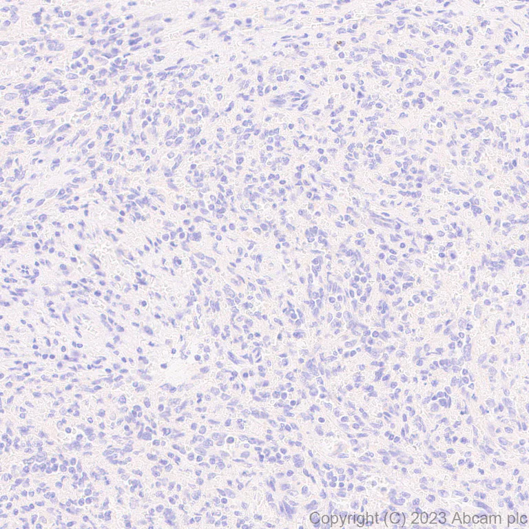 Immunohistochemistry (Formalin/PFA-fixed paraffin-embedded sections) - Anti-ABCB11/BSEP antibody [EPR28773-83] - BSA and Azide free (AB315475)