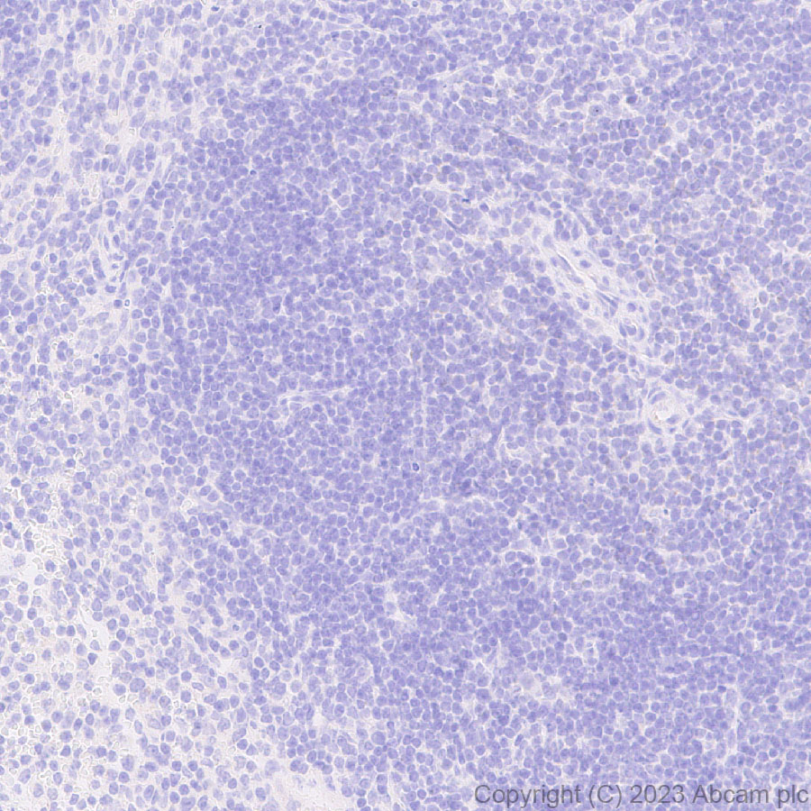 Immunohistochemistry (Formalin/PFA-fixed paraffin-embedded sections) - Anti-ABCB11/BSEP antibody [EPR28773-83] - BSA and Azide free (ab315475), expandable thumbnail