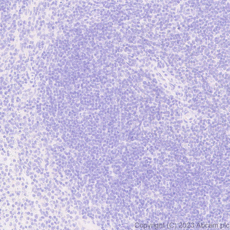 Immunohistochemistry (Formalin/PFA-fixed paraffin-embedded sections) - Anti-ABCB11/BSEP antibody [EPR28773-83] - BSA and Azide free (AB315475)