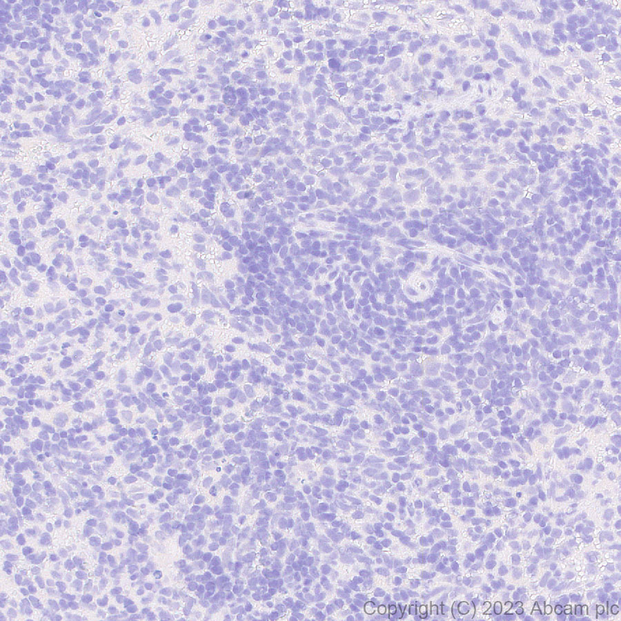 Immunohistochemistry (Formalin/PFA-fixed paraffin-embedded sections) - Anti-ABCB11/BSEP antibody [EPR28773-83] - BSA and Azide free (ab315475), expandable thumbnail