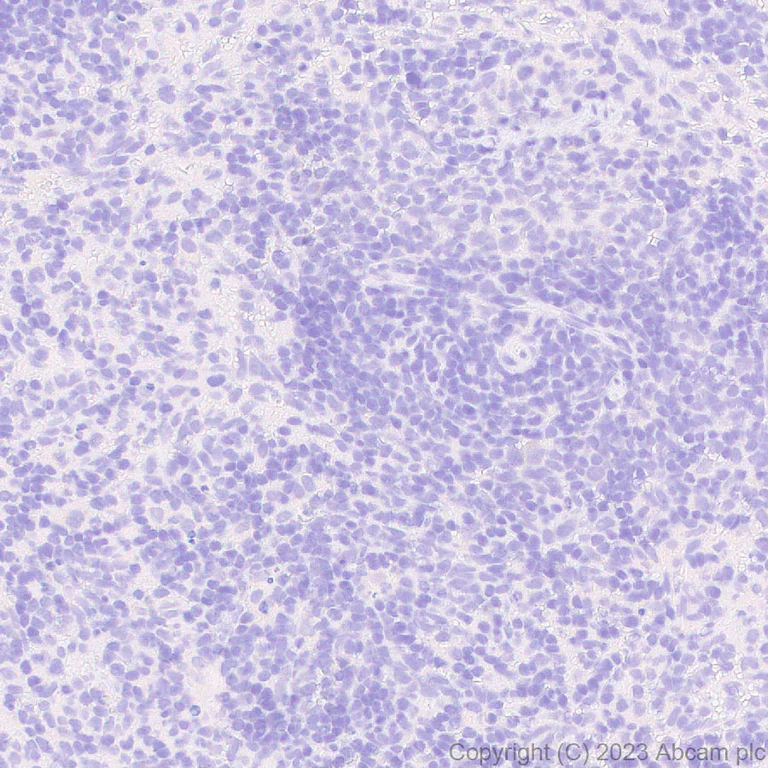 Immunohistochemistry (Formalin/PFA-fixed paraffin-embedded sections) - Anti-ABCB11/BSEP antibody [EPR28773-83] - BSA and Azide free (AB315475)
