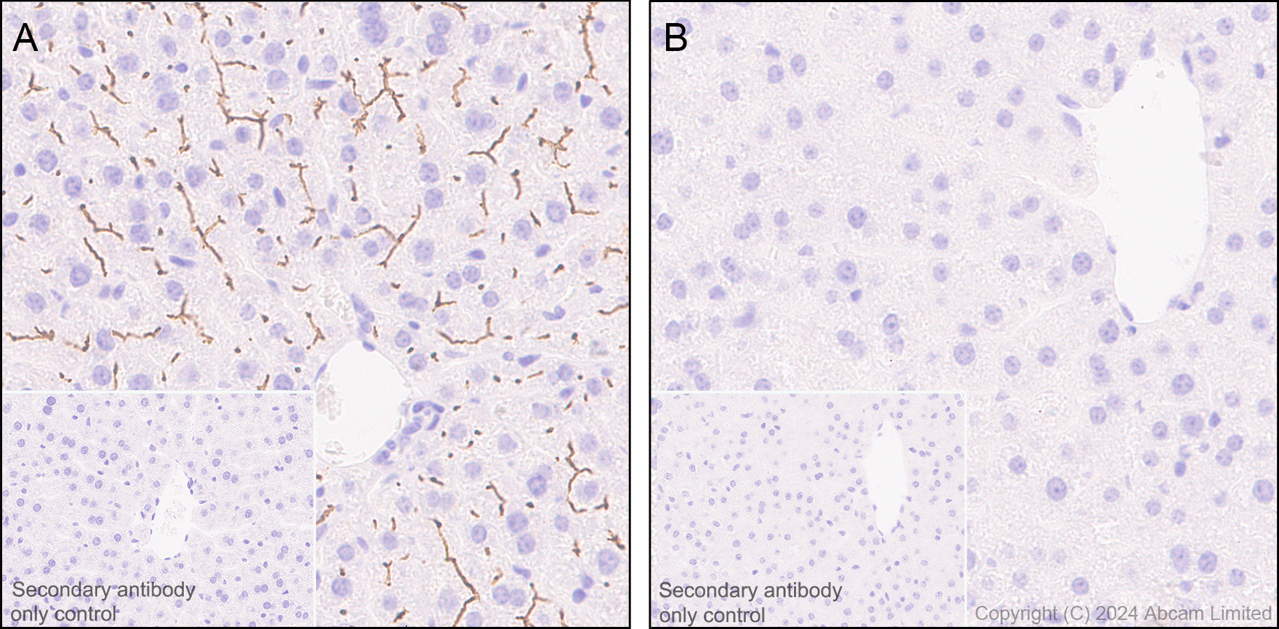 Immunohistochemistry (Formalin/PFA-fixed paraffin-embedded sections) - Anti-ABCB11/BSEP antibody [EPR28773-83] - BSA and Azide free (ab315475), expandable thumbnail