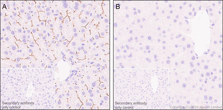 Immunohistochemistry (Formalin/PFA-fixed paraffin-embedded sections) - Anti-ABCB11/BSEP antibody [EPR28773-83] - BSA and Azide free (AB315475)