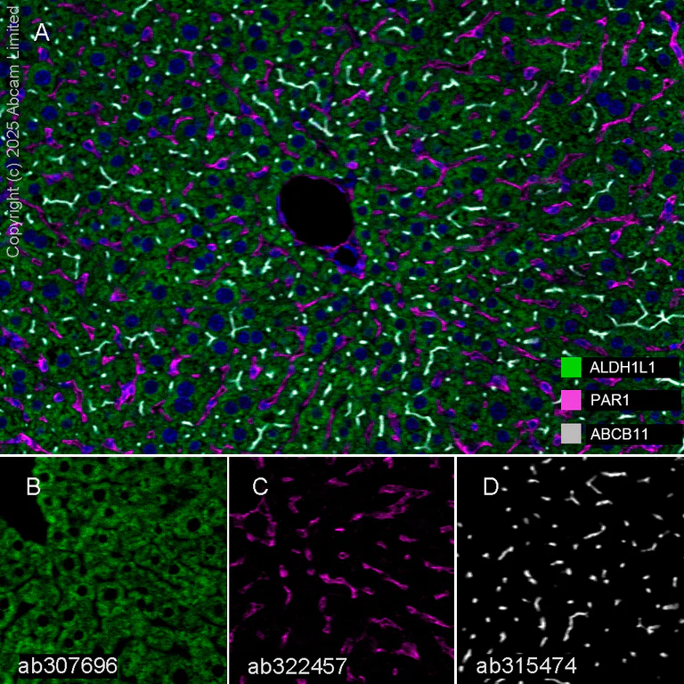 Multiplex immunohistochemistry - Anti-ABCB11/BSEP antibody [EPR28773-83] - BSA and Azide free (AB315475)